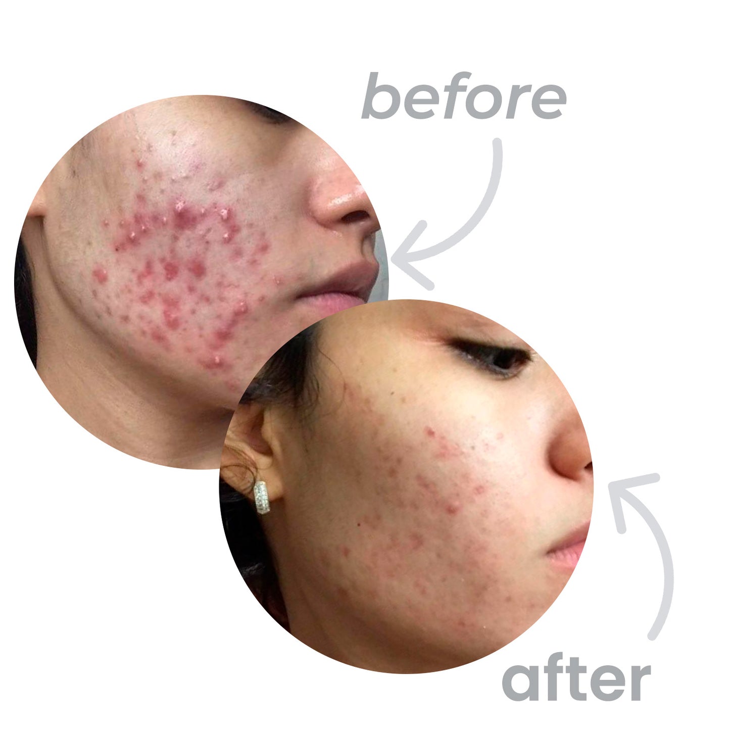 CREAMY Get Glowing Combo-Creamy Skincare