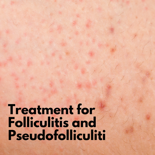 Treatment for Folliculitis and Pseudofolliculitis