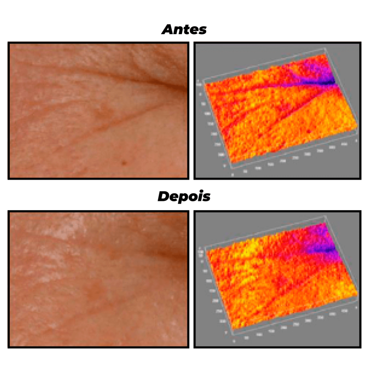 Creamy Retinol - Intensive Anti-Aging Treatment-Creamy Skincare